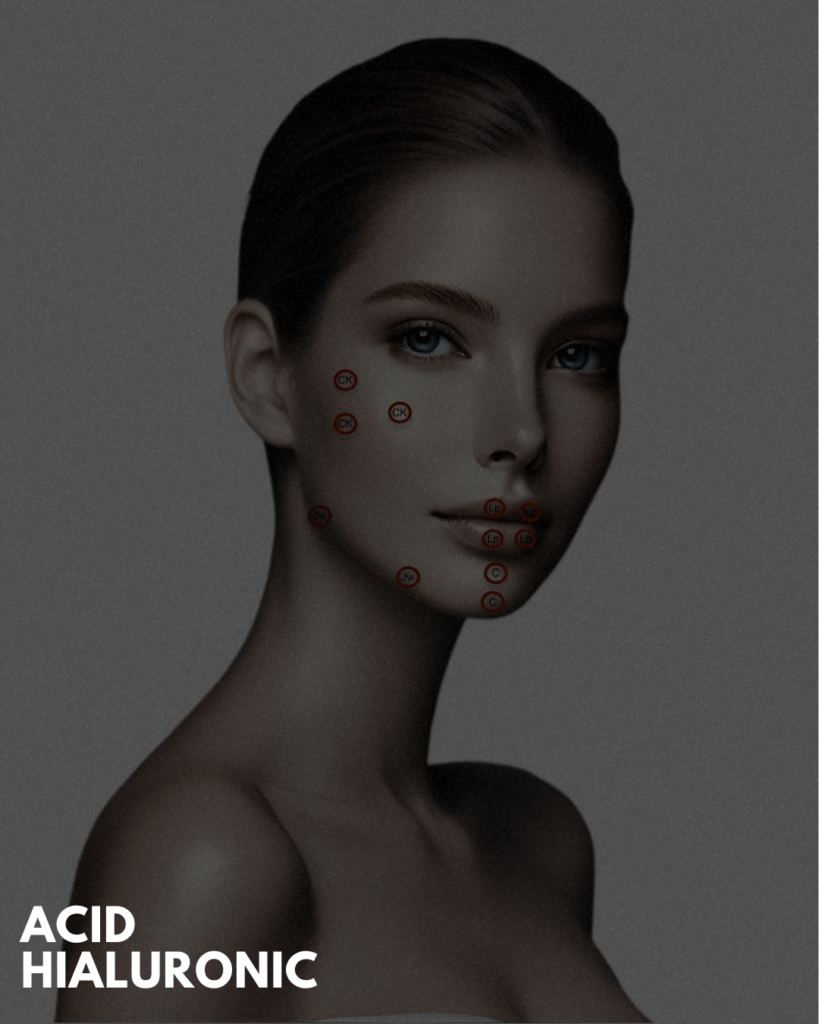 Recomandări post injecție acid hialuronic